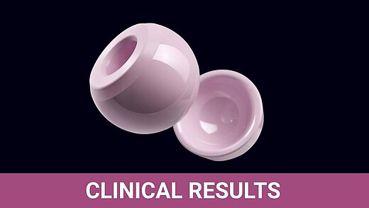 Pink BIOLOX delta ceramic femoral head and acetabular liner on black background, labelled Clinical Results.