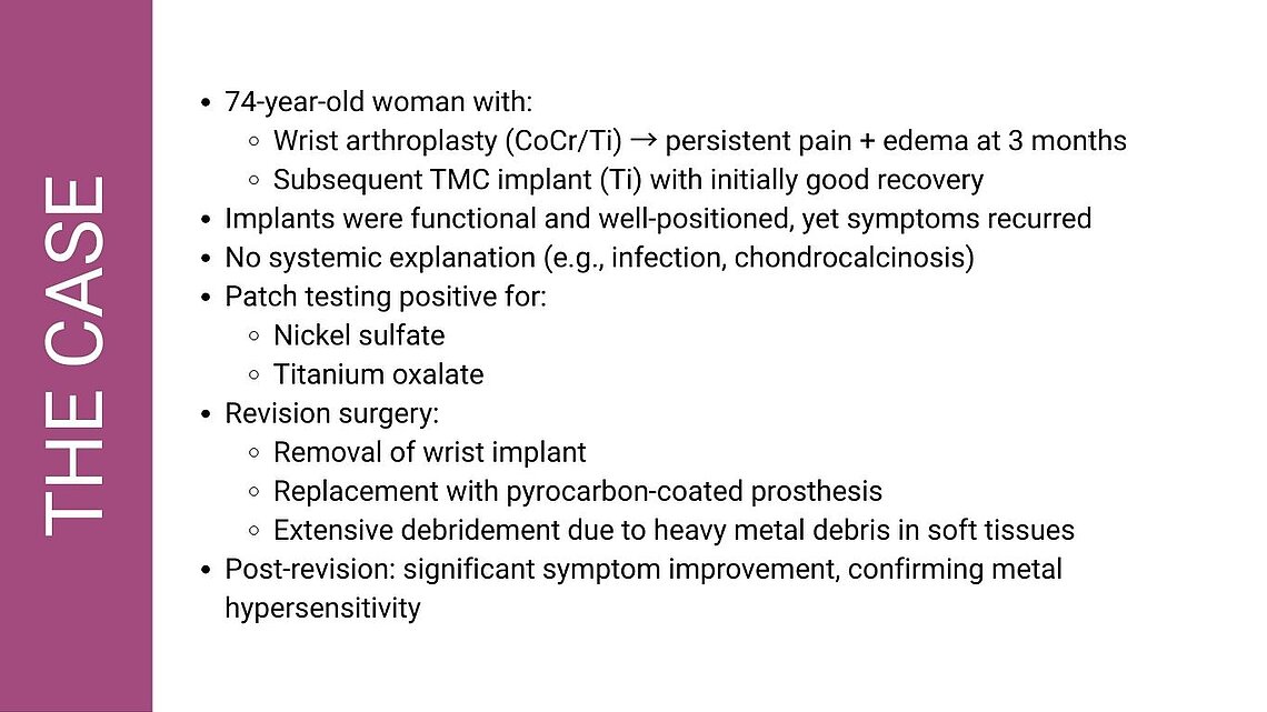 Graphic summarizing a wrist arthroplasty case involving persistent pain and edema, positive patch testing for nickel and titanium hypersensitivity, removal of metal implants, debridement of metal debris, and symptom improvement after revision to a pyrocarbon‑coated prosthesis.