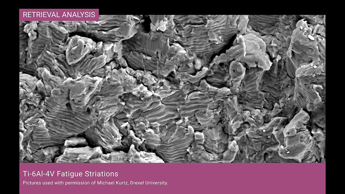 SEM image at 2,000x magnification showing fatigue striations on a Ti-6Al-4V fracture surface from a revision TKA implant retrieval.