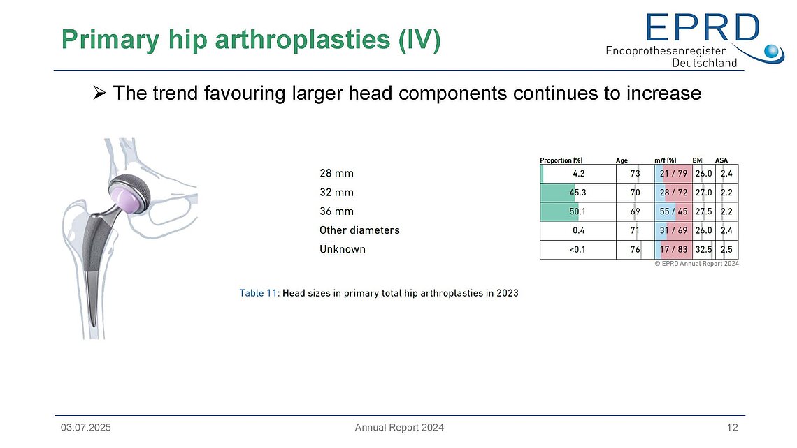 Infographic from EPRD Annual Report 2024 showing trends in femoral head sizes for primary hip arthroplasty, with a notable rise in 36-mm heads. Includes a diagram of hip implant and a data table comparing head size usage.