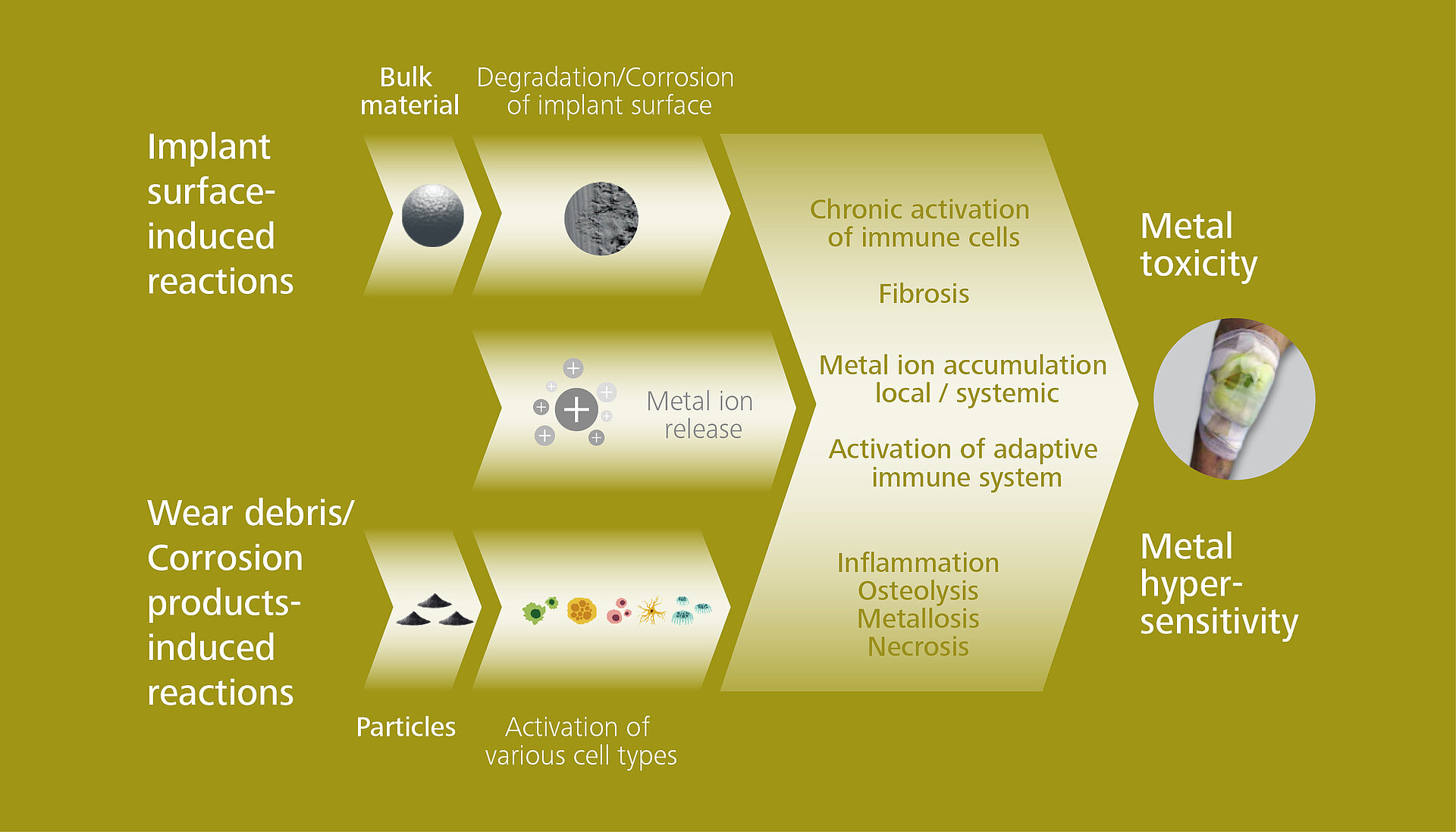 Implant and wear debris induced reactions