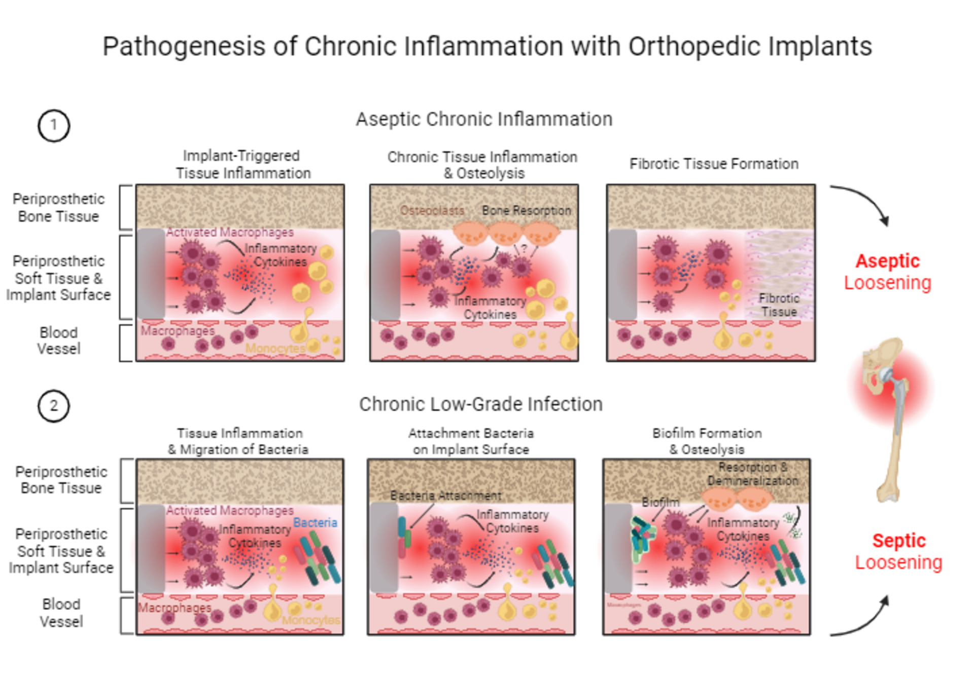 Figure 2 Inflammation vs. Infection in the CeraNews issue 2/2024. Article: Chronic Inflammation by Prof. Dr. Catherine Van Der Straeten