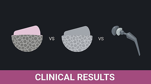 Graphic showing three hip implant concepts: a ceramic‑on‑ceramic hip resurfacing design, a metal‑on‑metal hip resurfacing design, and a conventional total hip replacement with a femoral stem. The lower banner reads “Clinical Results,” indicating a comparison of clinical performance outcomes.
