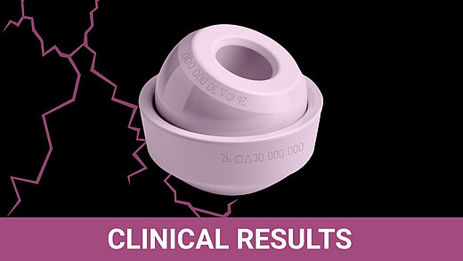 BIOLOX® ceramic femoral head and acetabular insert with clinical results banner and ceramic fracture graphic