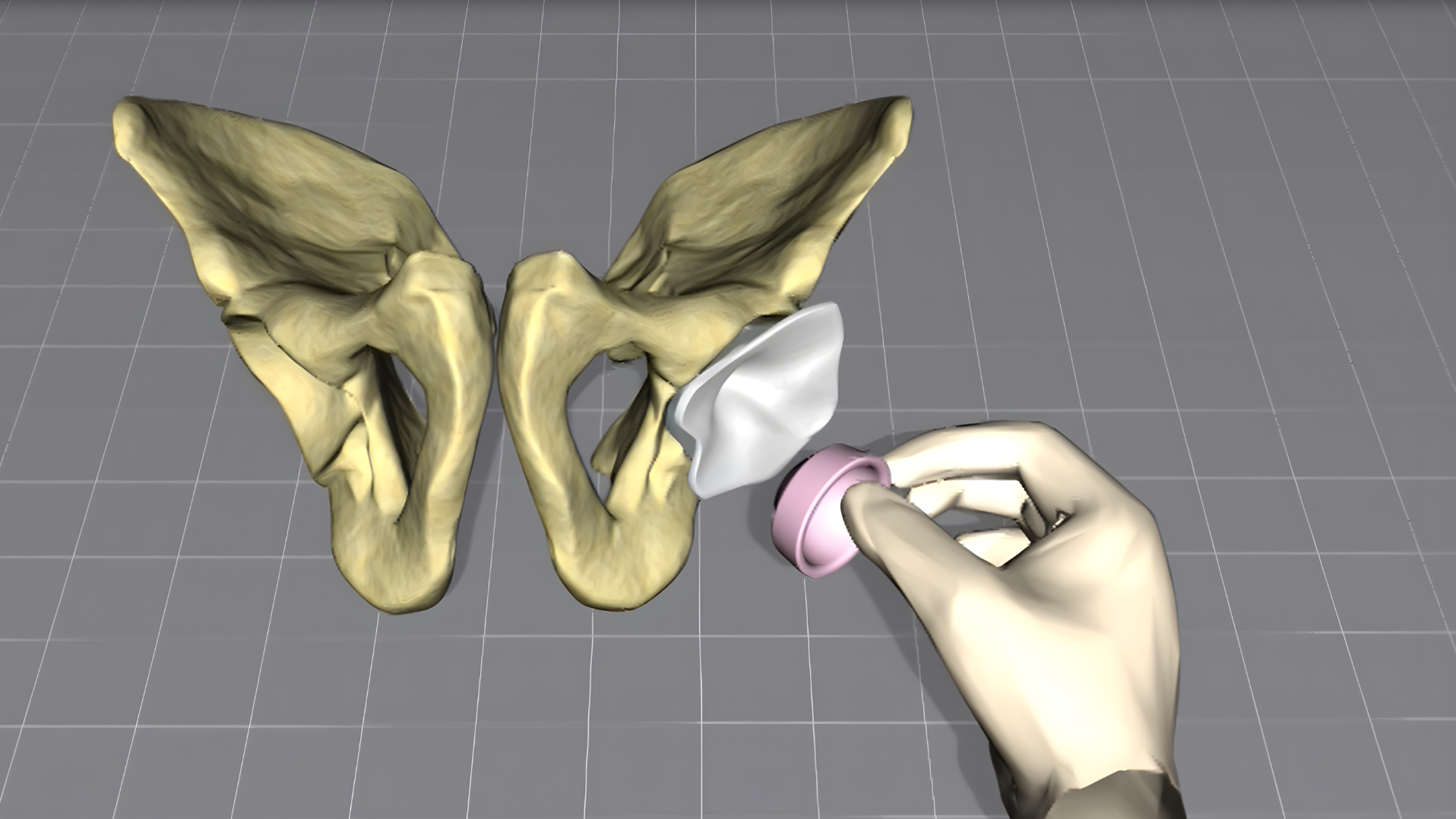 Animation on how to insert a BIOLOX® Liner