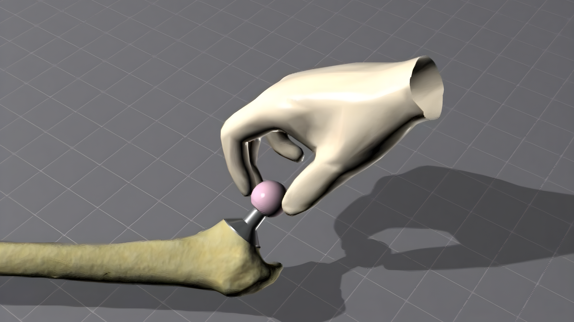 Animation on how to impact a BIOLOX®delta femoral head onto the femoral Taper