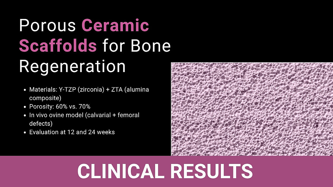 Microscopic view of porous ceramic scaffold with study parameters: Y-TZP, ZTA, 60–70% porosity, ovine model, 12–24 weeks.