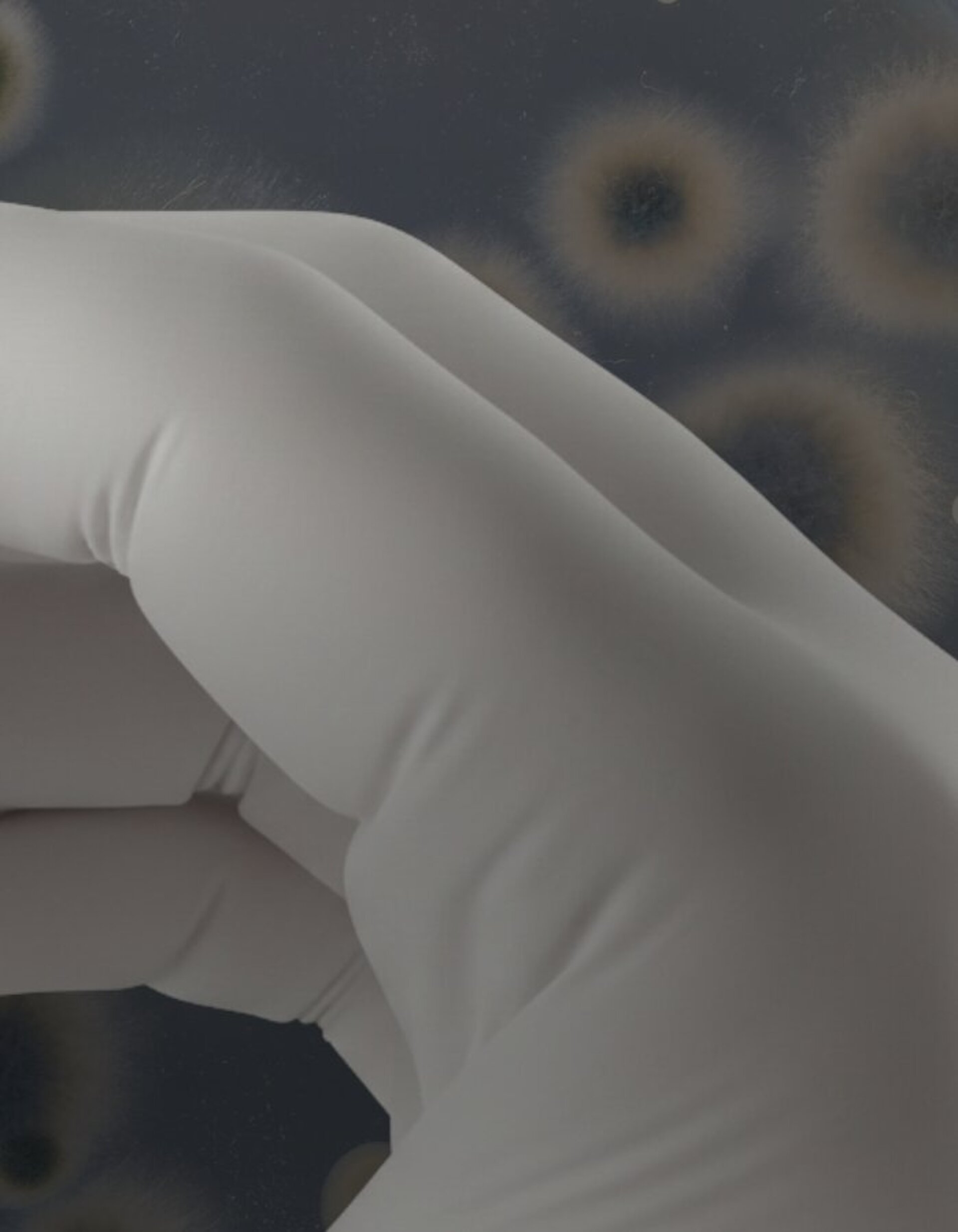 Gloved hand holding a BIOLOX®delta ceramic femoral head component against a blurred bacterial culture background.