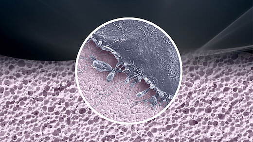 BIOLOX®delta ceramics failed to stimulate immunological responses